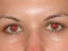 Vörös szem effektus